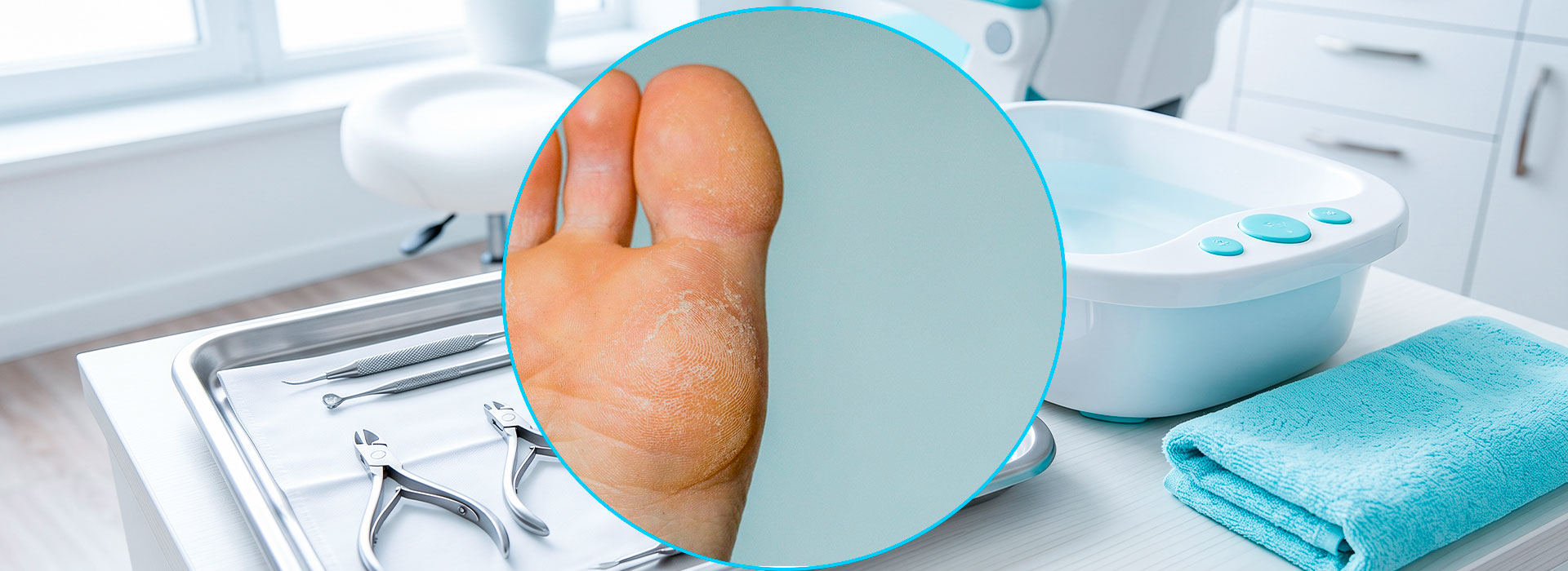 Callosité du pied